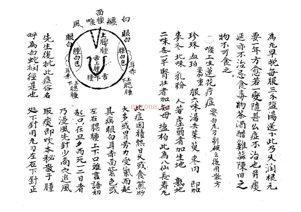 《咽喉秘传》