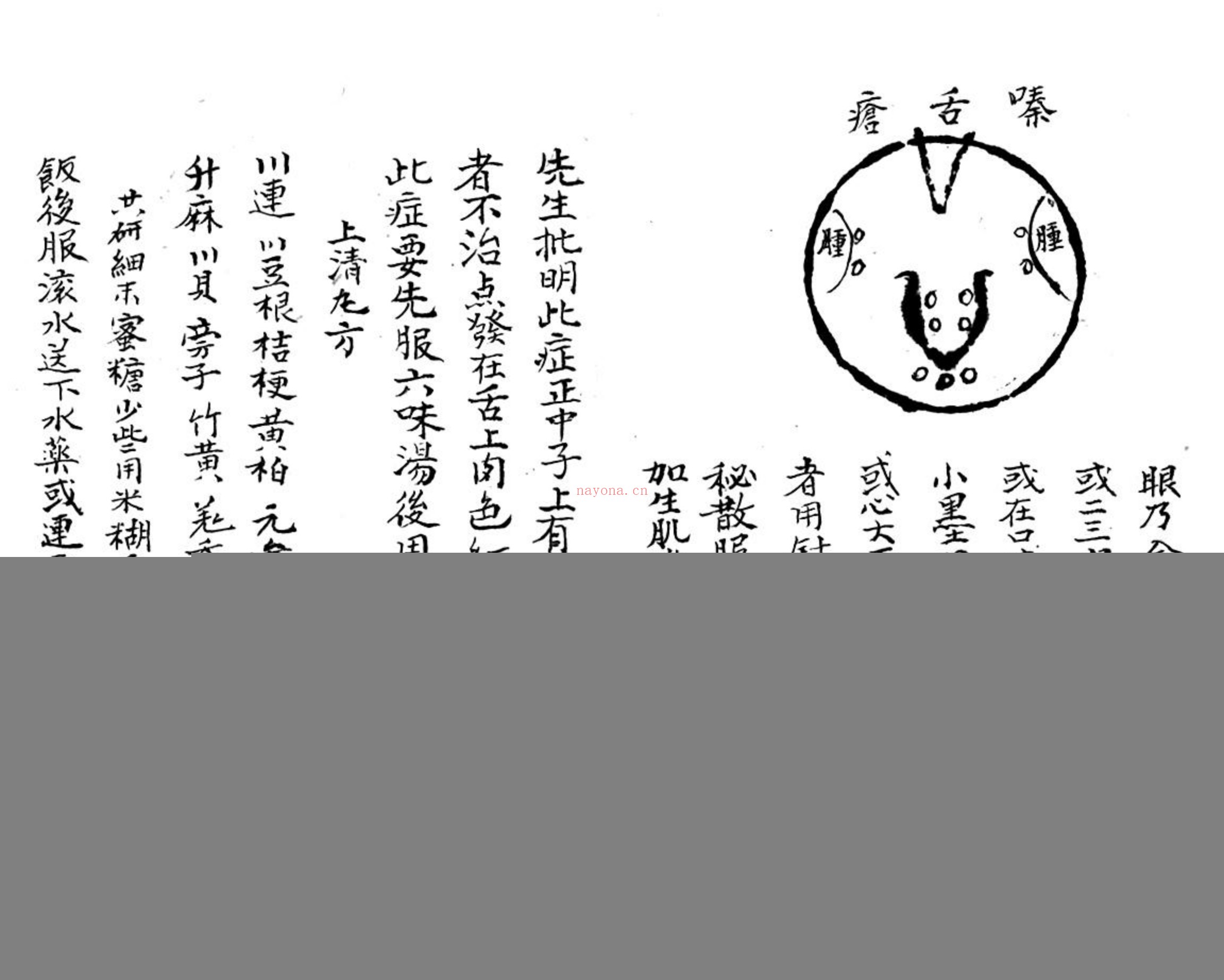 咽喉秘传