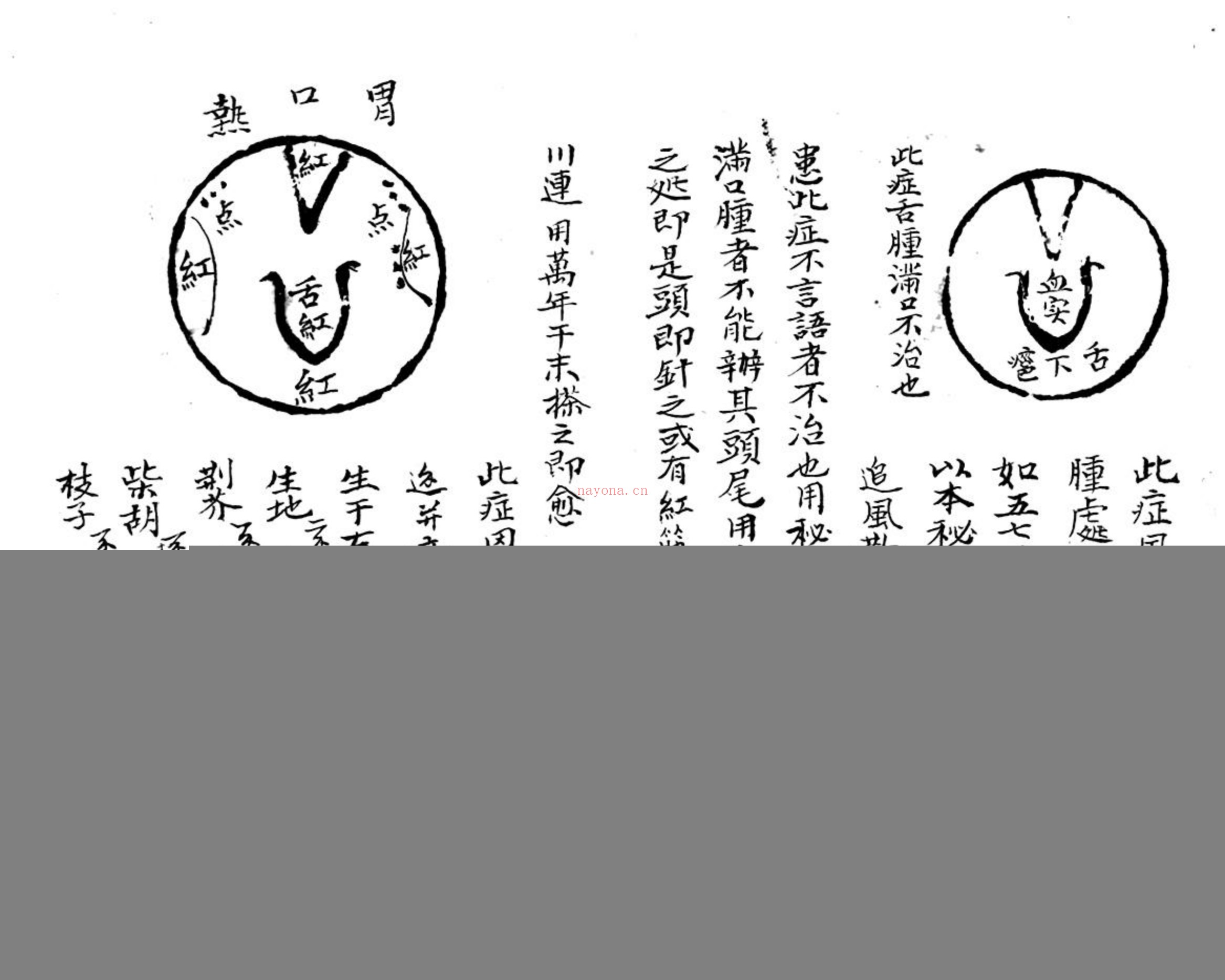 咽喉秘传