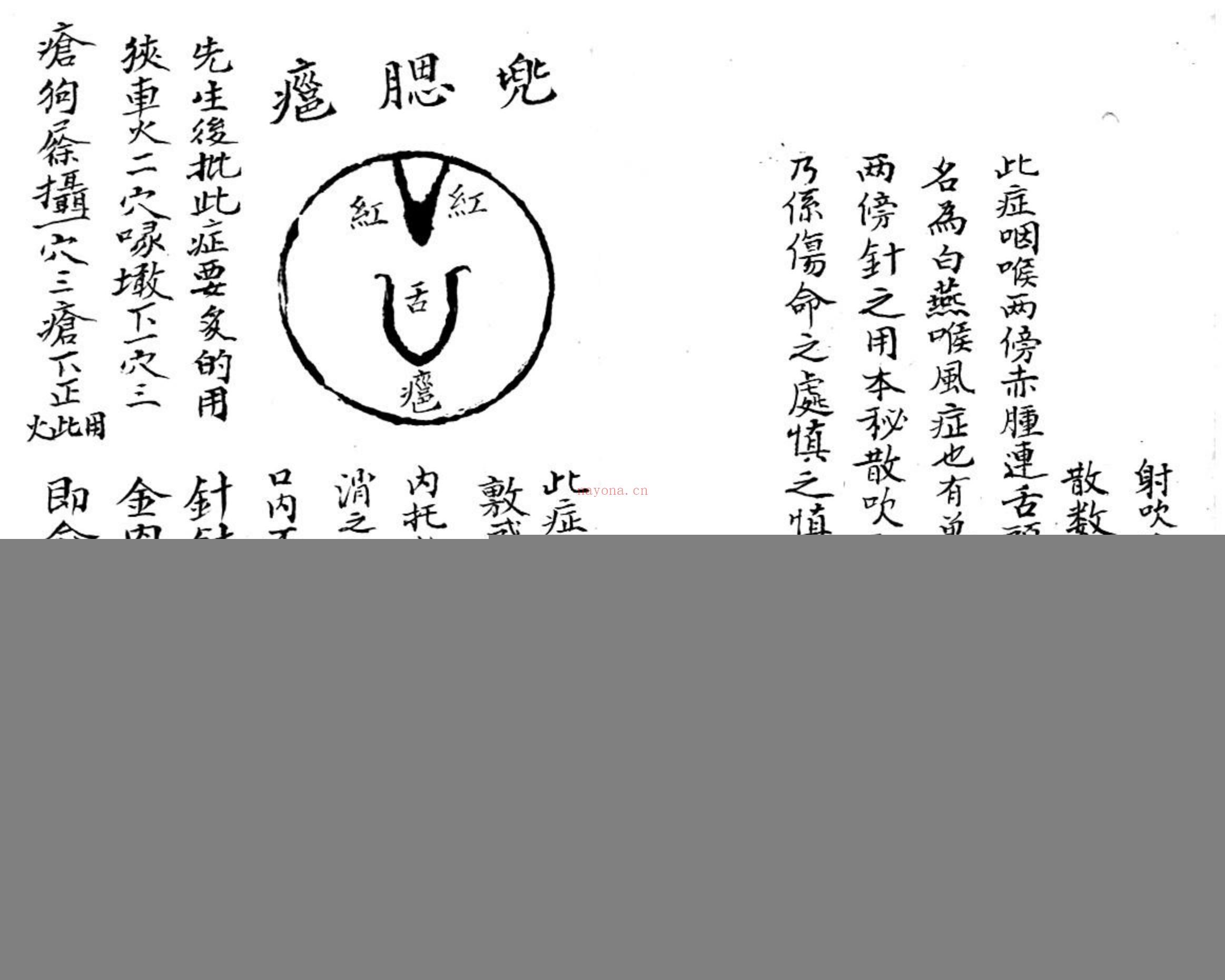 咽喉秘传