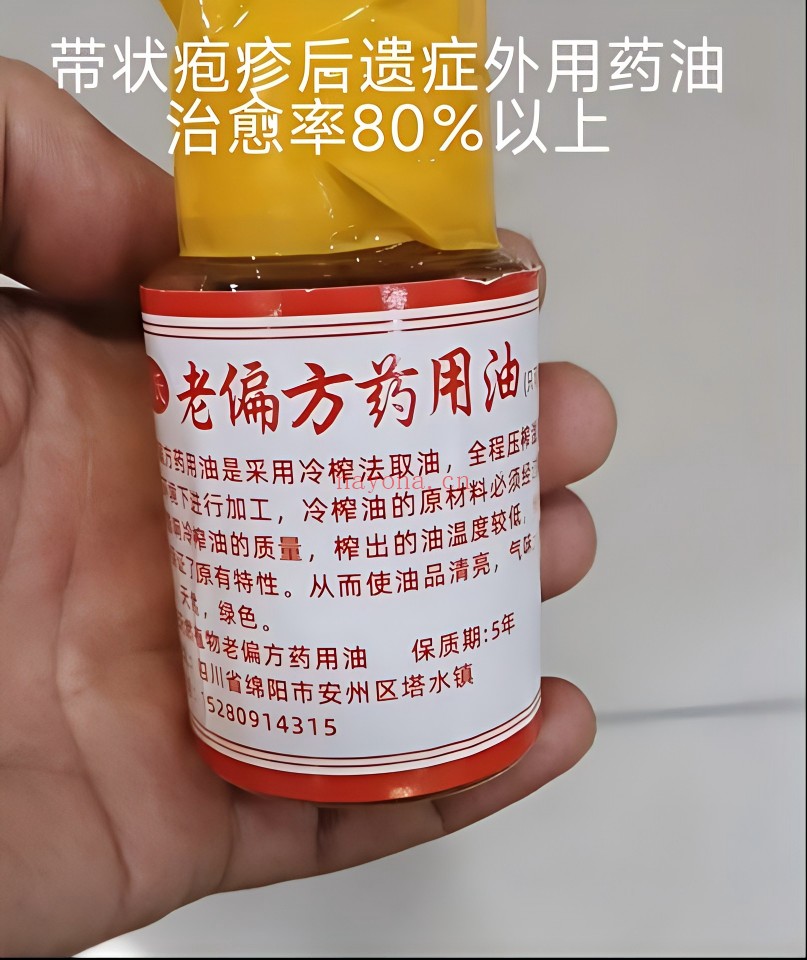 带状疱疹后遗症外用药油：中医资料与调理参考